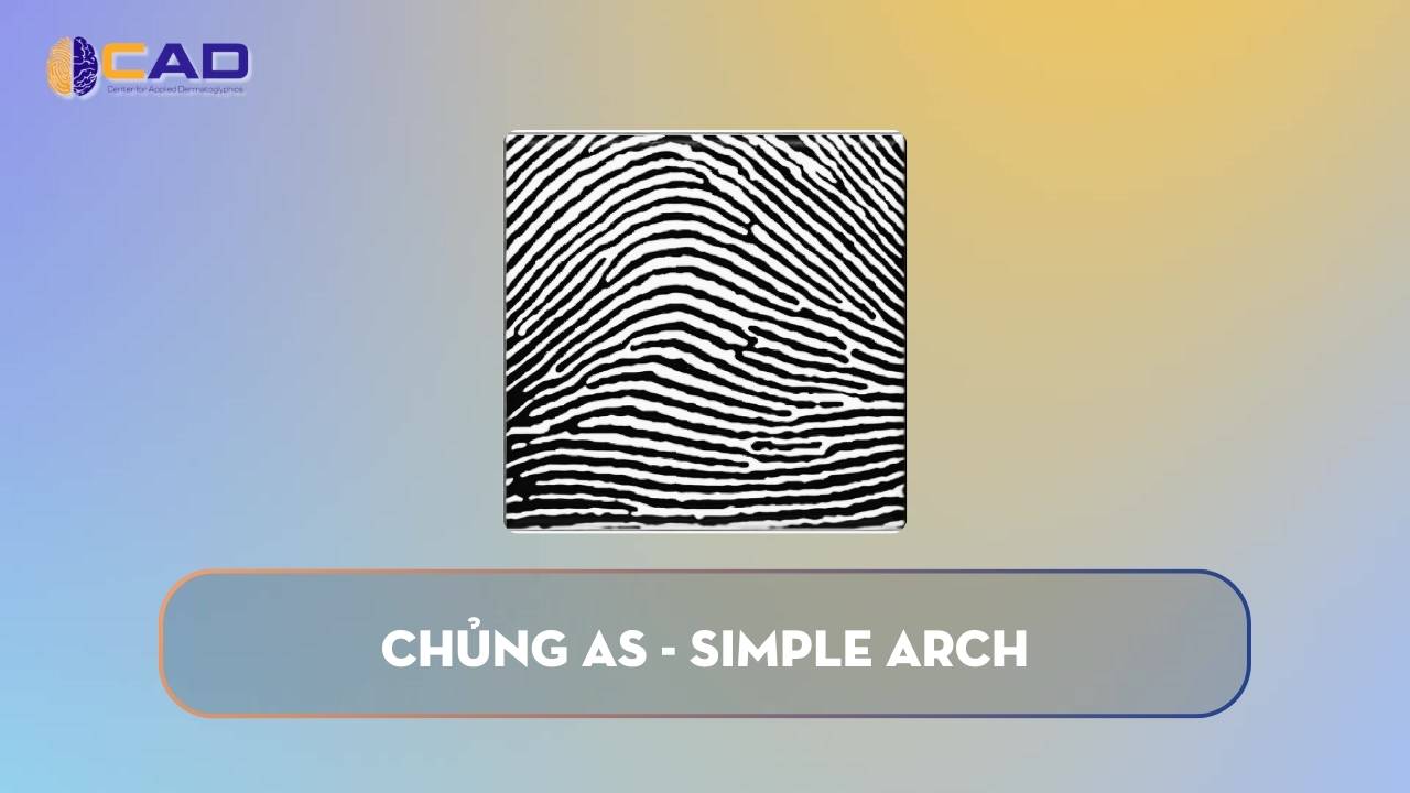 Chủng AS - Simple Arch