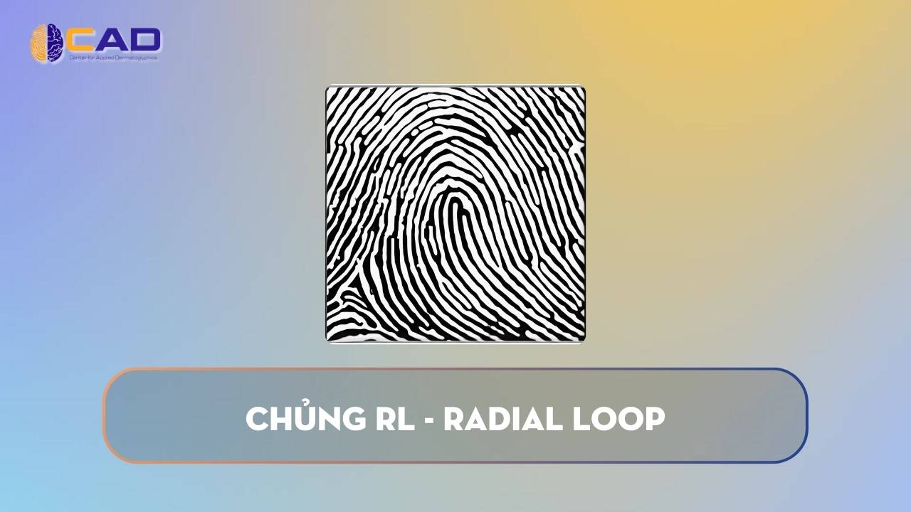 Chủng RL - Radial Loop