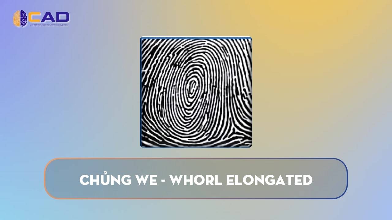 Chủng WE - Whorl Elongated