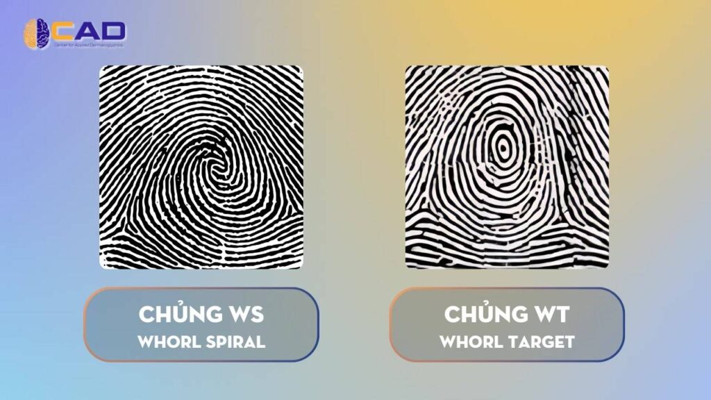 1. Đặc Điểm Nổi Bật Của Chủng Vân Tay WS (Whorl Spiral)