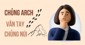 Vân Tay Chủng Núi (ARCH) Có Điểm Gì ĐẶC BIỆT? [2025]