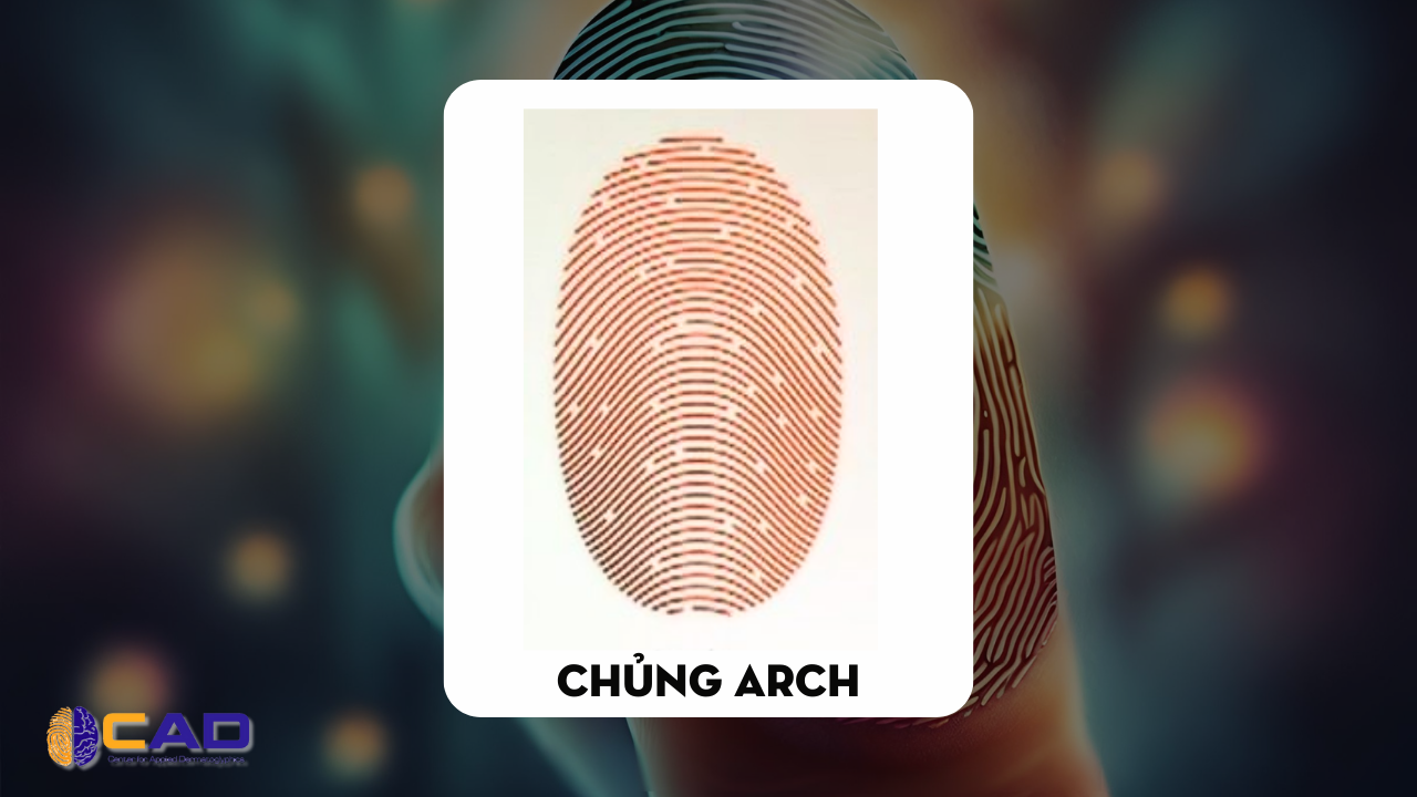 1. Vân Tay Chủng Núi (Arch) – Mẫu Vân Tay Hiếm Nhất